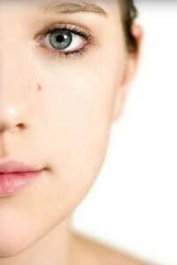 Natural Skin Care & best tips for acne problemes
