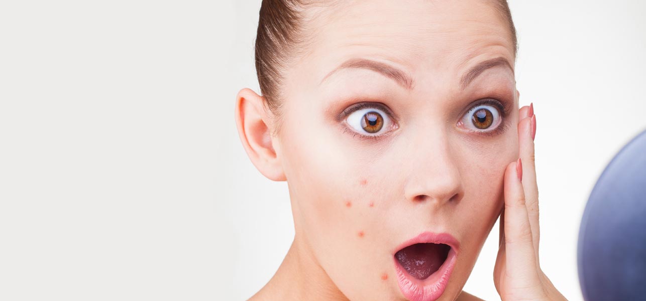 Boils on Face,Treatment and Causes of Boils & Information on Acne Boils