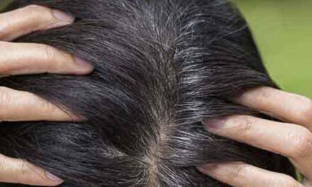 Prevent White Hair, Causes And Treatment