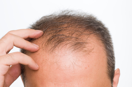 Hair Loss at post 60 calls for immediate attention