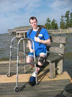 Best Exercise And Treatment For Post Polio Residual Paralysis