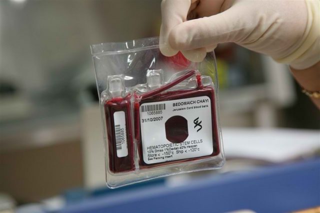 Some Frequently asked questions regarding Cord Blood Banking